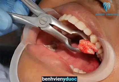 ADOR Dental - Phòng khám nha khoa uy tín Củ Chi Củ Chi Hồ Chí Minh