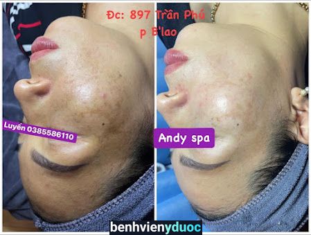 ANDY SPA Bảo Lộc Lâm Đồng