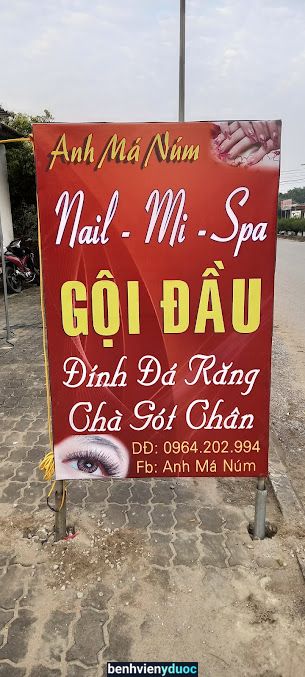 Anh má núm Spa Hải Hậu Nam Định