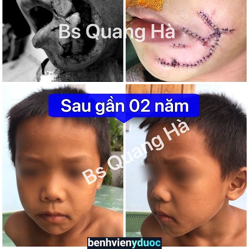 Bác sĩ Nguyễn Quang Hà Vinh Nghệ An