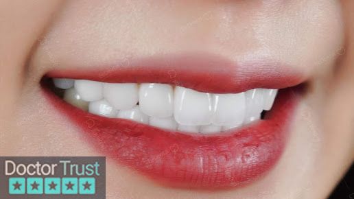 Be Dental - Nha Khoa Uy tín 15 năm, Chuyên Làm Răng Sứ thẩm mỹ, Trồng răng implant, Nhổ răng khôn tại Thành phố Vinh, Nghệ An Vinh Nghệ An