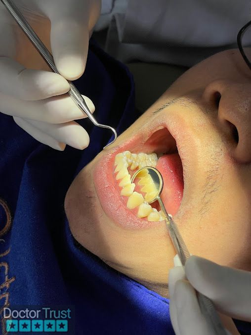 Be Dental - Nha Khoa Uy tín 15 năm, Chuyên Làm Răng Sứ thẩm mỹ, Trồng răng implant, Nhổ răng khôn tại Thành phố Vinh, Nghệ An Vinh Nghệ An