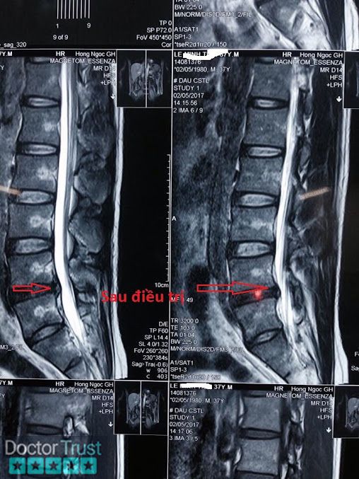 Bs Hào: Vật lý trị liệu Phục hồi chức năng Hoài Đức Hà Nội