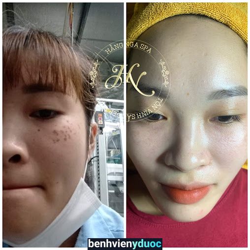 Hằng Nga Beauty Spa Bình Lục Hà Nam