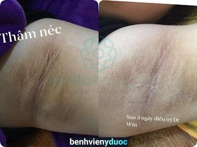 Hathor Beauty Spa Phú Diễn Nam Từ Liêm Hà Nội