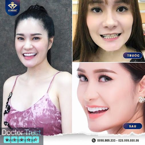 Hệ Thống Nha Khoa Thẩm Mỹ ST Dentist - CN Quy Nhon Quy Nhơn Bình Định