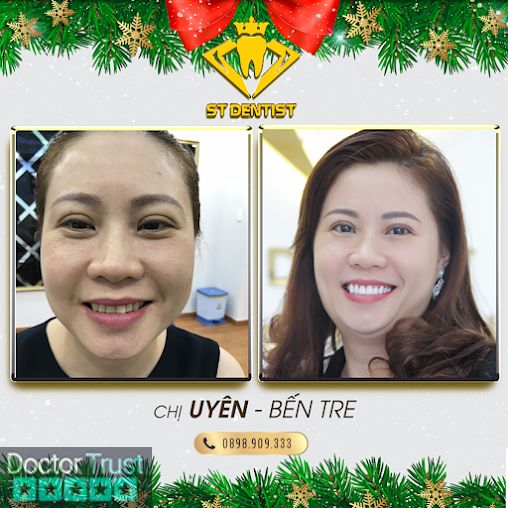 Hệ Thống Nha Khoa Thẩm Mỹ ST Dentist - CN Quy Nhon Quy Nhơn Bình Định