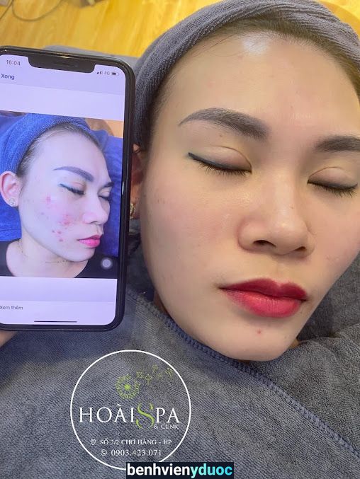 Hoài Spa & Clinic - Điều trị Da uy tín Hải Phòng Lê Chân Hải Phòng