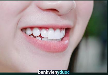 K DENTIST - Nha khoa ở Quảng Ngãi Quảng Ngãi Quảng Ngãi