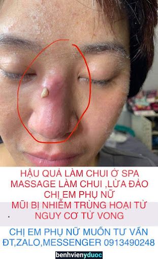 L.BBvien thẩm mỹ quốc tế BSMCHAU hàn quốc Quy Nhơn Bình Định