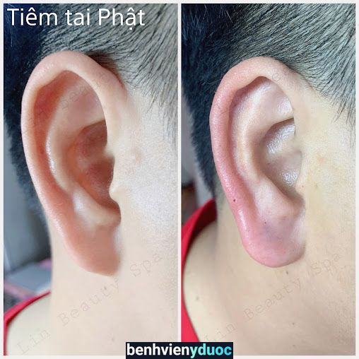 Lin Beauty Spa Tân Uyên Bình Dương