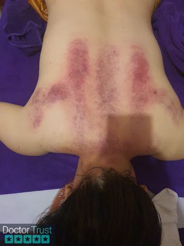 Massage Châm Cứu Ấn Huyệt Trị Liệu - Đà Lạt Đà Lạt Lâm Đồng