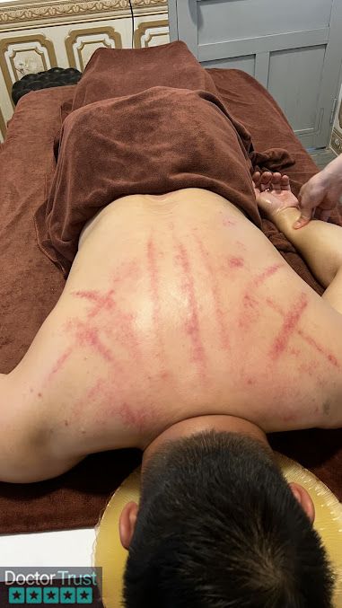 Massage Châm Cứu Bấm Huyệt Trị Liệu- Bảo Lộc Bảo Lộc Lâm Đồng