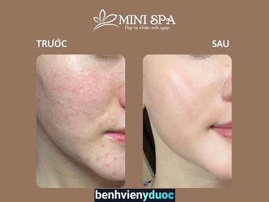 Mini Spa Cầu Giấy Hà Nội