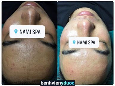 NaMi Spa Cầu Giấy Hà Nội