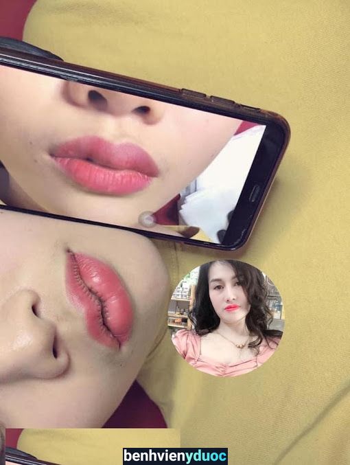 Ngân spa Bắc Giang Bắc Giang