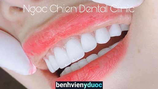 Ngọc Chiến Dental&Clinic