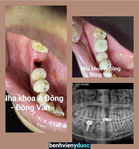 Nha Khoa Á Đông(Dental clinic) Duy Tiên Hà Nam