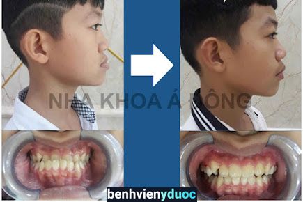 Nha Khoa Á Đông(Dental clinic) Duy Tiên Hà Nam