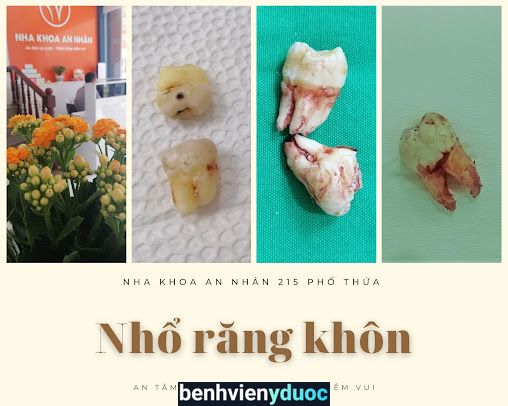 NHA KHOA AN NHÂN 215 PHỐ THỨA Mỹ Hào Hưng Yên