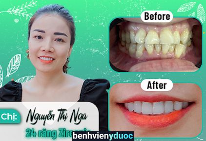 NHA KHOA ASIA UY TÍN QUẬN 9 TP HCM - NIỀNG RĂNG - BỌC RĂNG SỨ - TRỒNG RĂNG IMPLANT - TẨY TRẮNG RĂNG - NHỔ RĂNG KHÔN GIÁ RẺ Thủ Đức Hồ Chí Minh