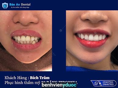 Nha Khoa Bao An Dental Tân Bình Hồ Chí Minh