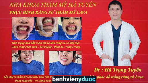 Nha Khoa Dr Ha Tuyen Chương Mỹ Hà Nội