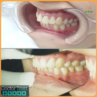 Nha Khoa Dr.Tooth - Dr.Tooth Dental Clinic- Nha Khoa Uy Tín Nha Trang