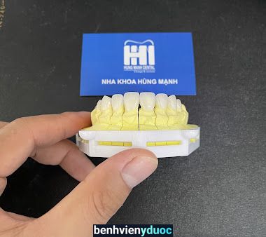 Nha Khoa Hùng Mạnh Lục Nam Bắc Giang