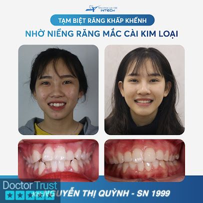 Nha khoa Lạc Việt Intech - 22 Cao Thắng, Tp.Vinh, Nghệ An Vinh Nghệ An