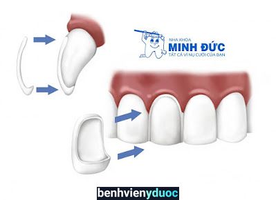 Nha Khoa Minh Đức Chi Nhánh 3 Tân Bình Hồ Chí Minh