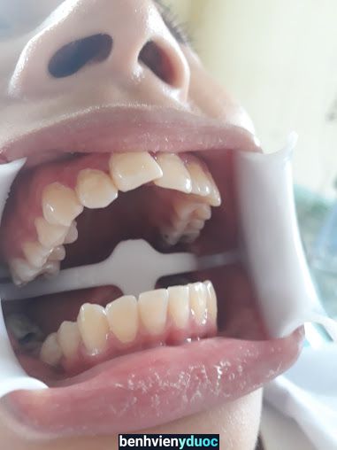 Nha khoa Phạm Phong Phù Cừ Hưng Yên