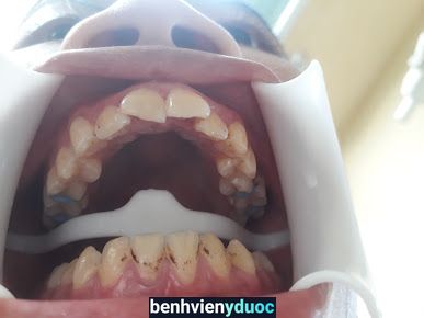 Nha khoa Phạm Phong Phù Cừ Hưng Yên