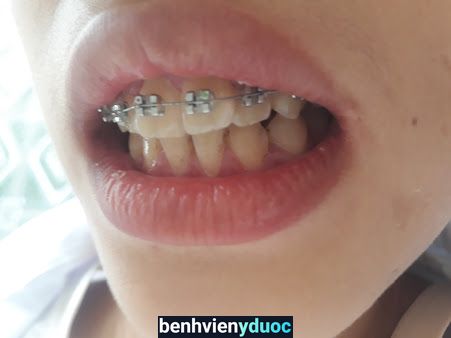 Nha khoa Phạm Phong Phù Cừ Hưng Yên