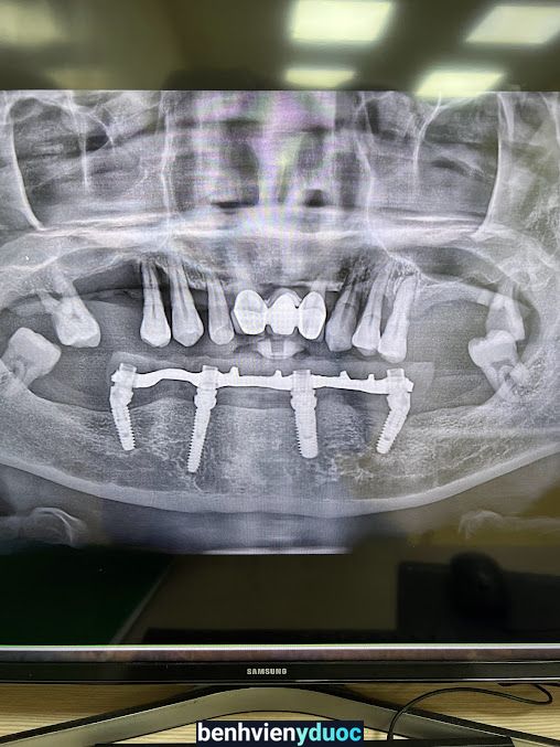 Nha khoa Phước An Lạng Sơn Lạng Sơn