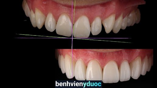Nha khoa Quốc tế Lương Giang Đức Thọ Hà Tĩnh
