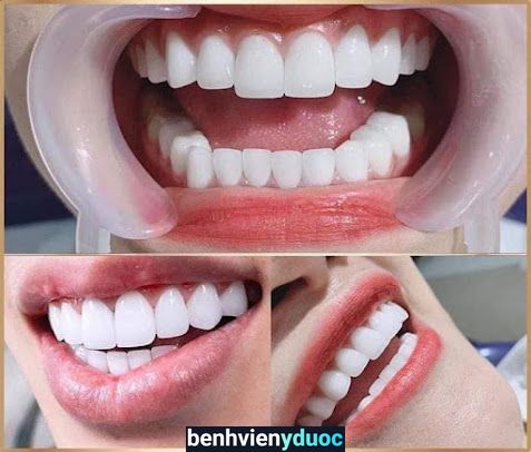 Nha Khoa RUBY SMILE An Nhơn Bình Định