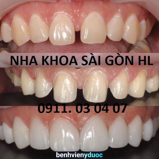 Nha khoa Sài Gòn HL - Niềng Răng Không Nhổ Răng Bà Rịa Bà Rịa - Vũng Tàu