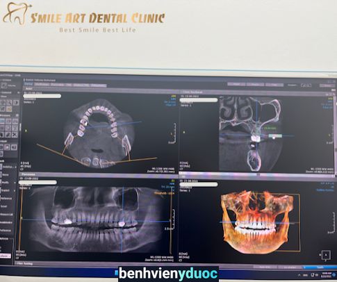 Nha Khoa SMILE ART 299 Vĩnh Viễn - Cấy Ghép Implant 10 Hồ Chí Minh