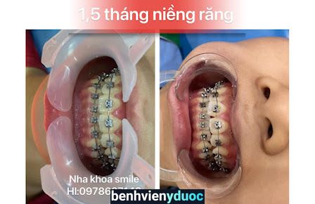 Nha khoa Smile Tân Tây Đô Đan Phượng Hà Nội