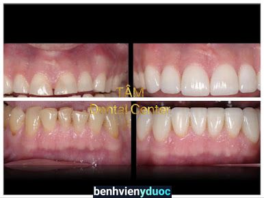 Nha Khoa TÂM Dental Center DrC&T UY TÍN - CHẤT LƯỢNG - TẬN TÂM Mỹ Tho Tiền Giang