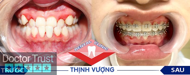 Nha Khoa Thịnh Vượng cơ sở 3 Ngô Quyền Hải Phòng