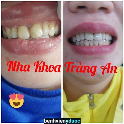 Nha Khoa Tràng An Bình Lục Hà Nam