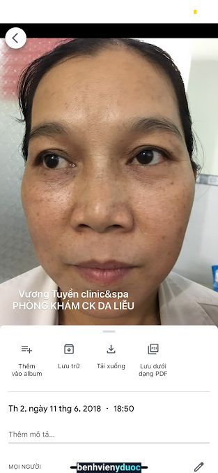 Phòng khám Chuyên khoa Da liễu Bác sĩ Vương - Spa Vương Tuyền - Điều trị -Chăm sóc da thẫm mỹ uy tín Tân Phú Đồng Nai