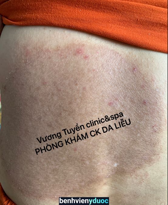 Phòng khám Chuyên khoa Da liễu Bác sĩ Vương - Spa Vương Tuyền - Điều trị -Chăm sóc da thẫm mỹ uy tín Tân Phú Đồng Nai