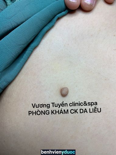 Phòng khám Chuyên khoa Da liễu Bác sĩ Vương - Spa Vương Tuyền - Điều trị -Chăm sóc da thẫm mỹ uy tín Tân Phú Đồng Nai