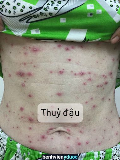 Phòng khám da liễu & thẩm mỹ Tân Lợi Hòa Thành Tây Ninh