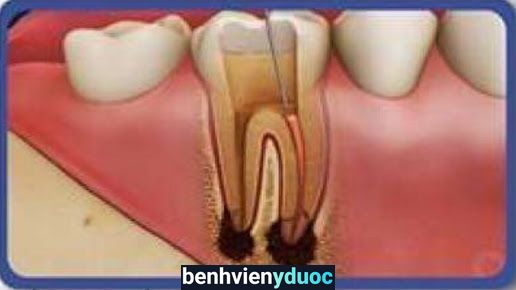 Phòng Khám Nha Khoa Đinh Toàn Gia Lộc Hải Dương