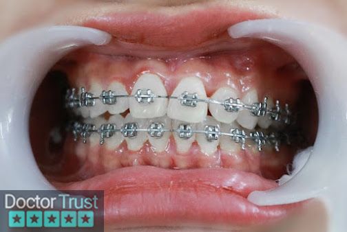 Phòng khám Nha Khoa Quốc Tế VinSmile | Phòng khám răng uy tín Bắc Ninh Từ Sơn Bắc Ninh