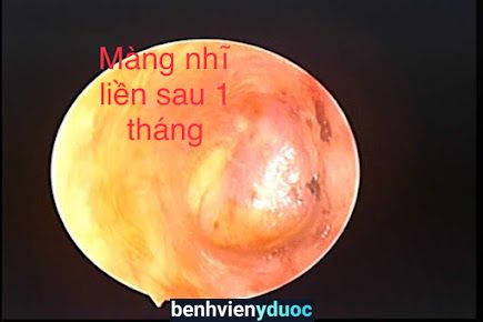 Phòng Khám Tai Mũi Họng Trẻ Em và Người Lớn - Phòng Khám Minh Châu 2 Ngọc Lặc Thanh Hóa